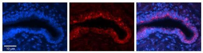 Ribophorin II Antibody in Immunohistochemistry (Paraffin) (IHC (P))