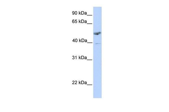 ST3GAL1 Antibody in Western Blot (WB)