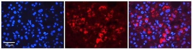 Tapasin Antibody in Immunohistochemistry (Paraffin) (IHC (P))