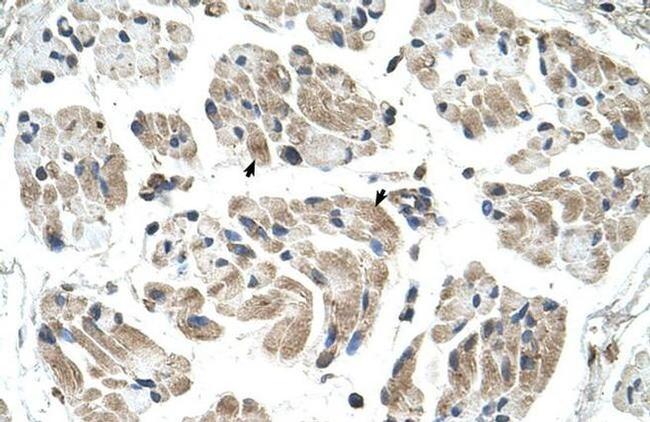 CHST1 Antibody in Immunohistochemistry (IHC)