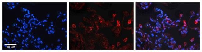 DEGS1 Antibody in Immunohistochemistry (Paraffin) (IHC (P))