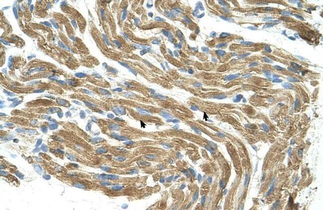 HAL Antibody in Immunohistochemistry (IHC)