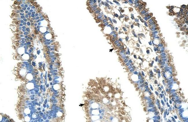 ALDH4A1 Antibody in Immunohistochemistry (IHC)