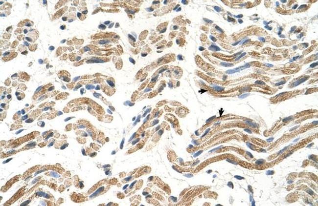 ALDH4A1 Antibody in Immunohistochemistry (IHC)