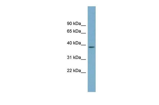 SDSL Antibody in Western Blot (WB)