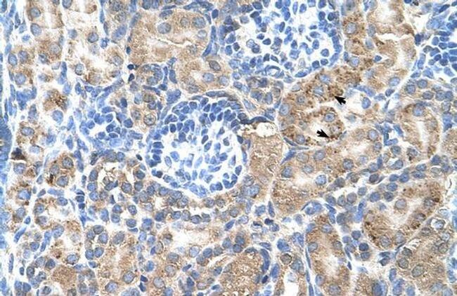 SGPP2 Antibody in Immunohistochemistry (IHC)