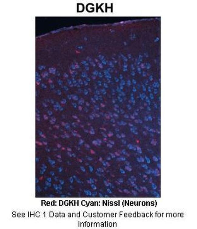 DGKH Antibody in Immunohistochemistry (IHC)