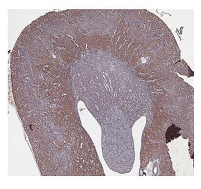 CBS Antibody in Immunohistochemistry (IHC)