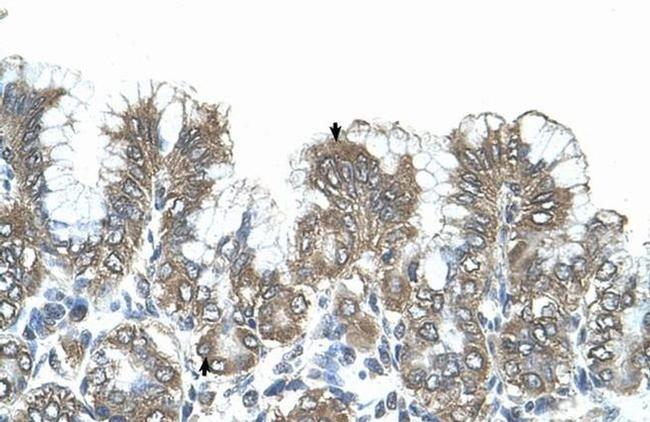 SIK1 Antibody in Immunohistochemistry (IHC)