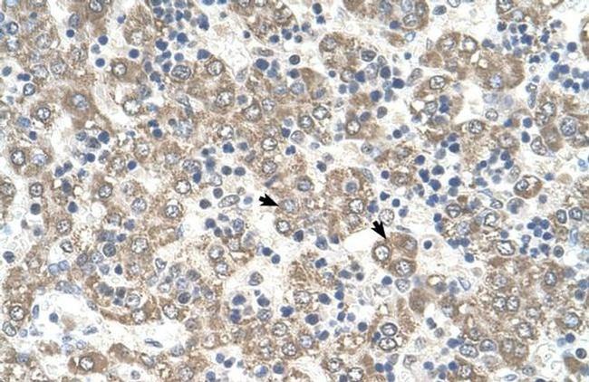 KYNU Antibody in Immunohistochemistry (IHC)