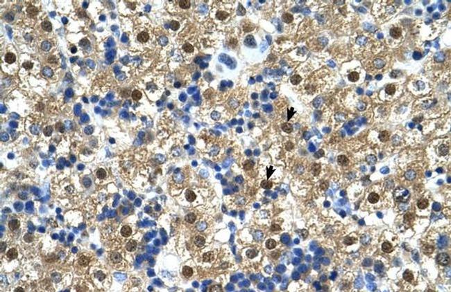 CTPS Antibody in Immunohistochemistry (IHC)