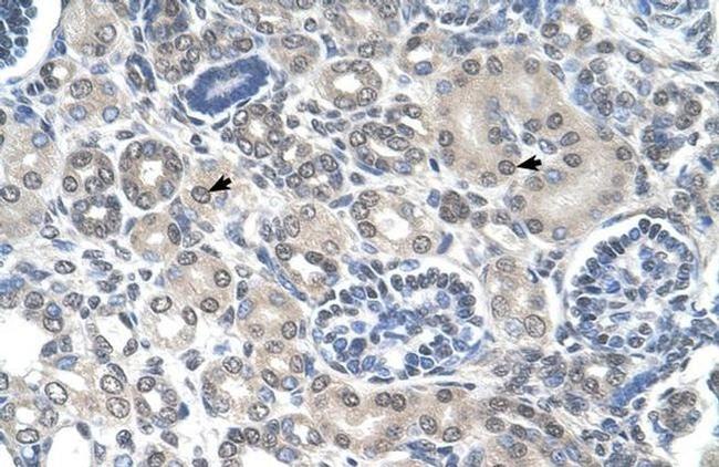 PPAT Antibody in Immunohistochemistry (IHC)