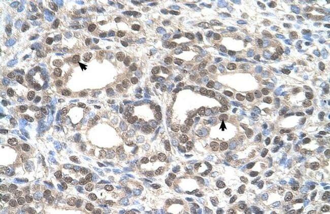 DFNA5 Antibody in Immunohistochemistry (IHC)