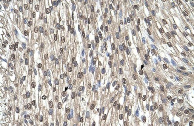 SHMT2 Antibody in Immunohistochemistry (IHC)