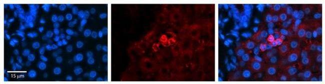 SHMT2 Antibody in Immunohistochemistry (Paraffin) (IHC (P))