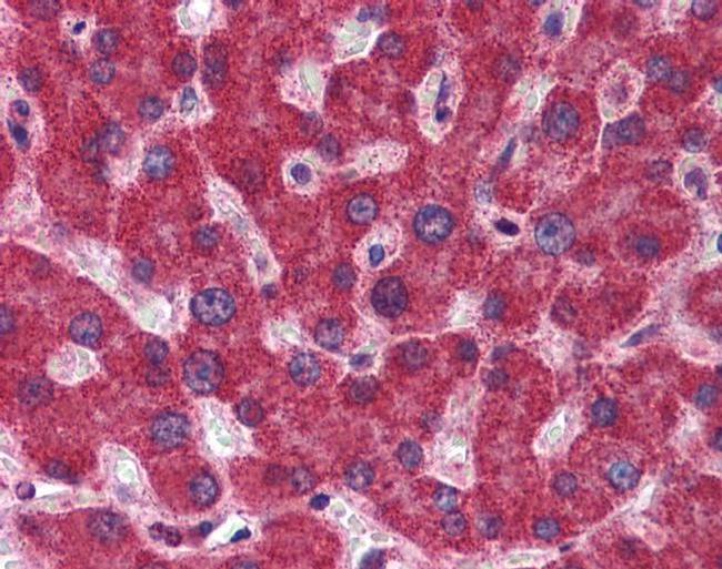 MTHFD1 Antibody in Immunohistochemistry (IHC)