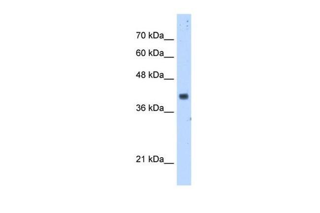 PDSS1 Antibody in Western Blot (WB)