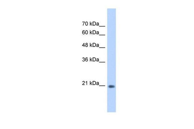 GINS2 Antibody in Western Blot (WB)