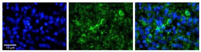 WBP11 Antibody in Immunohistochemistry (Paraffin) (IHC (P))