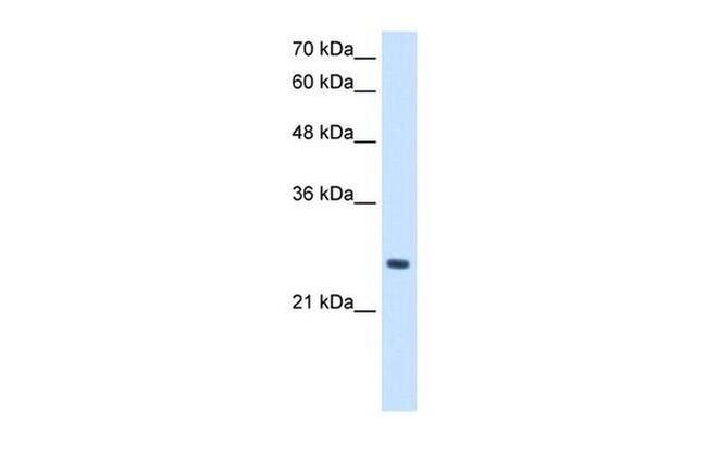 PPCDC Antibody in Western Blot (WB)