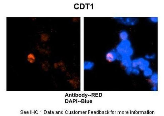 CDT1 Antibody in Immunohistochemistry (IHC)