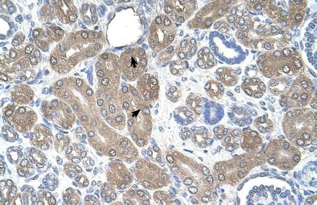 ST3GAL5 Antibody in Immunohistochemistry (IHC)