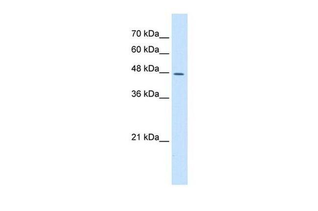 DDOST Antibody in Western Blot (WB)