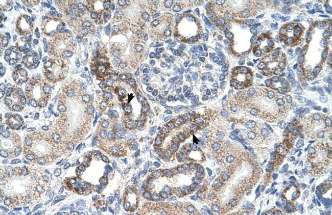 UST Antibody in Immunohistochemistry (IHC)