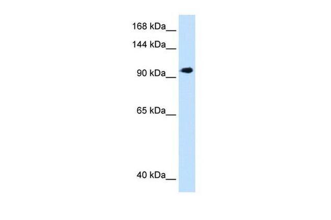 SEC63 Antibody in Western Blot (WB)