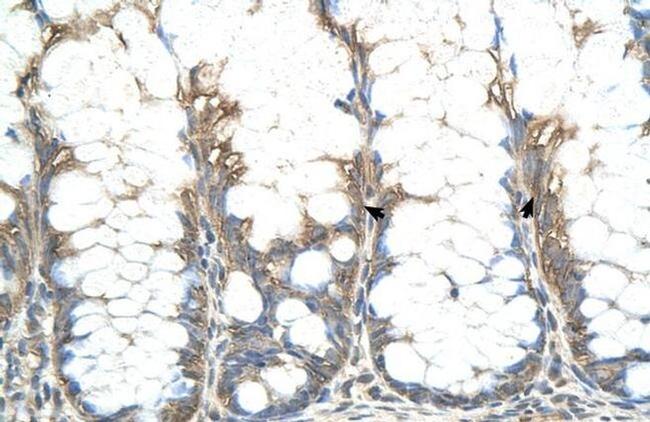 CHIC2 Antibody in Immunohistochemistry (IHC)