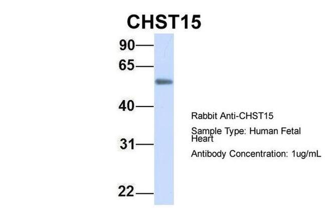 CHST15 Antibody in Western Blot (WB)