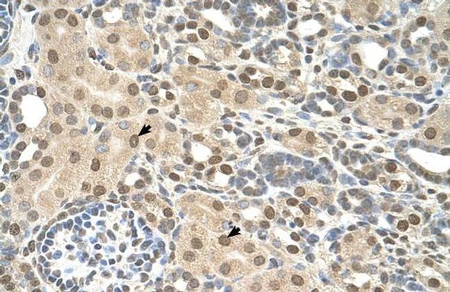 TMEM30A Antibody in Immunohistochemistry (Paraffin) (IHC (P))