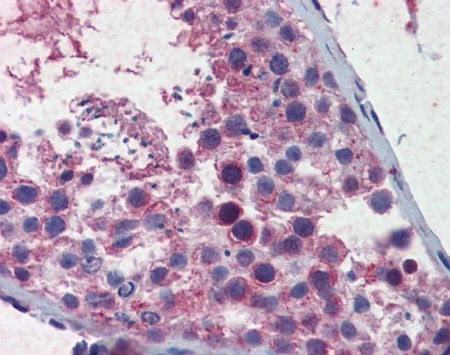 SMC3 Antibody in Immunohistochemistry (IHC)