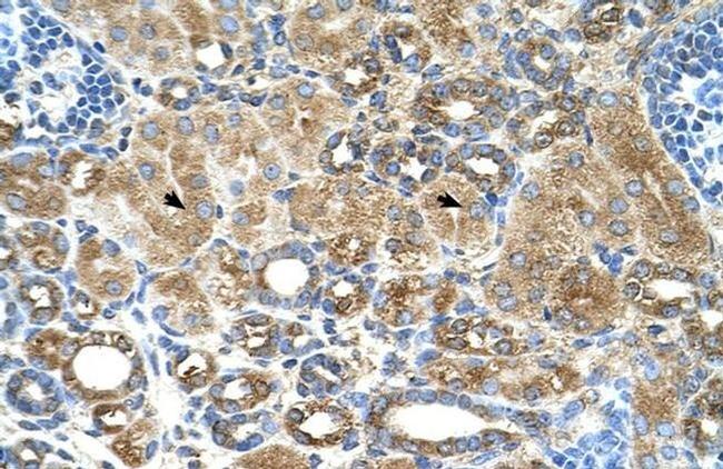 UBXD2 Antibody in Immunohistochemistry (IHC)