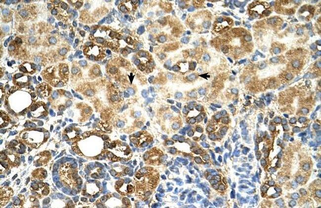 C3orf31 Antibody in Immunohistochemistry (IHC)