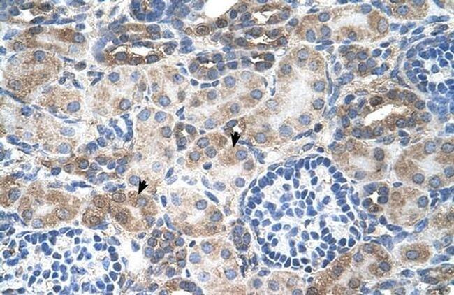 SLC14A1 Antibody in Immunohistochemistry (IHC)