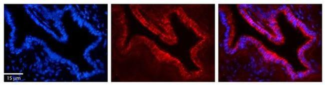 UMPS Antibody in Immunohistochemistry (Paraffin) (IHC (P))