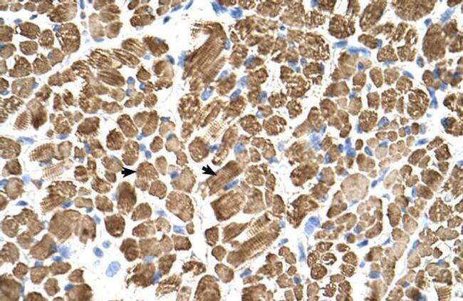 TPM2 Antibody in Immunohistochemistry (IHC)