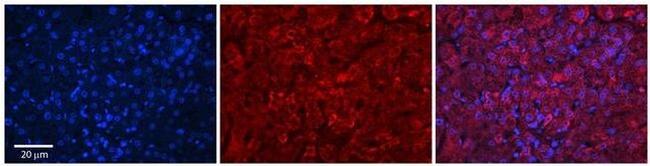 GRHPR Antibody in Immunohistochemistry (Paraffin) (IHC (P))