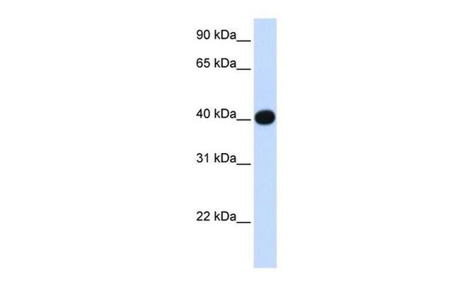 LIAS Antibody in Western Blot (WB)