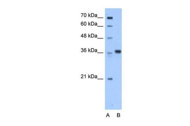 AASDHPPT Antibody in Western Blot (WB)