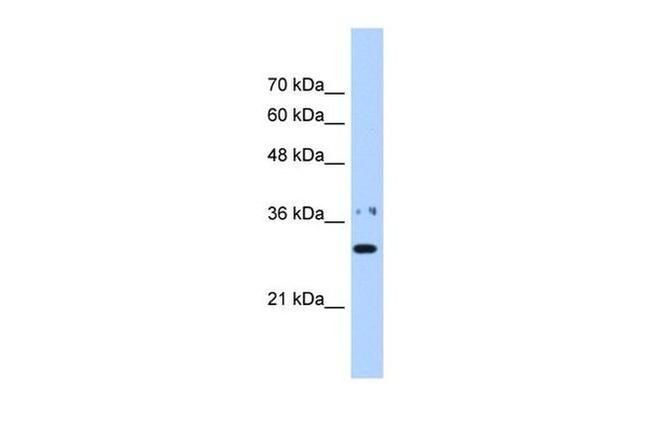 NMNAT1 Antibody in Western Blot (WB)