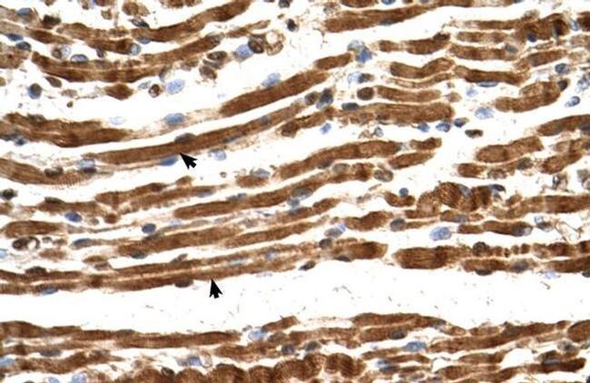 NAA16 Antibody in Immunohistochemistry (IHC)