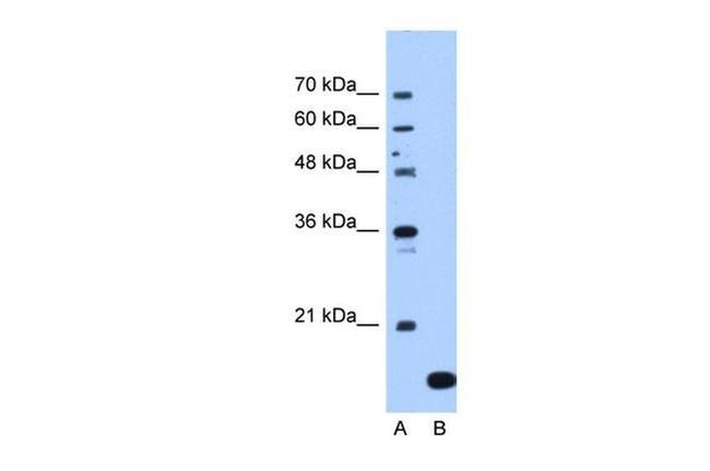 NAT13 Antibody in Western Blot (WB)