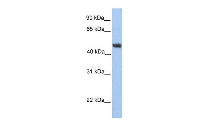 ALG2 Antibody in Western Blot (WB)