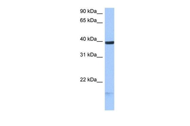 HS3ST5 Antibody in Western Blot (WB)