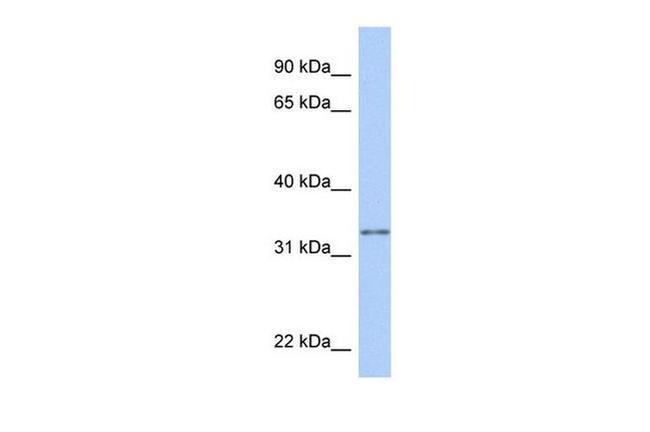 GSTO2 Antibody in Western Blot (WB)