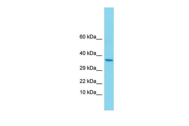 ALG1 Antibody in Western Blot (WB)