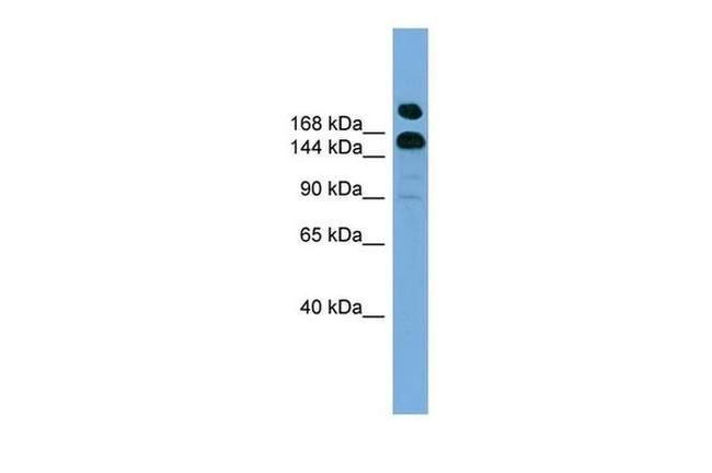 UGGT1 Antibody in Western Blot (WB)