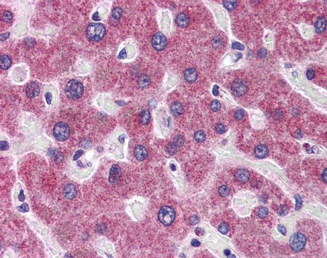 RHBG Antibody in Immunohistochemistry (IHC)